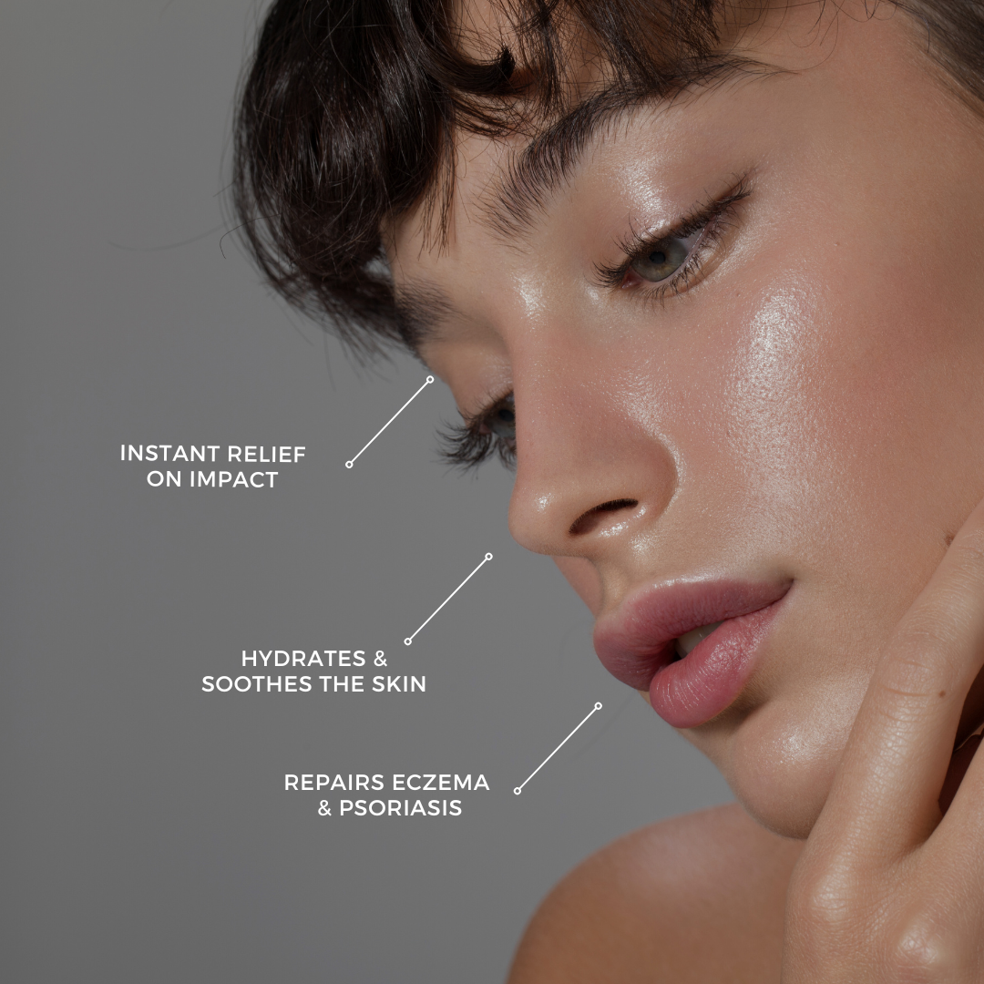 Anti Flare Up Spritz - 55ML | Steroid-Free Made From Plants - As Seen On Vogue