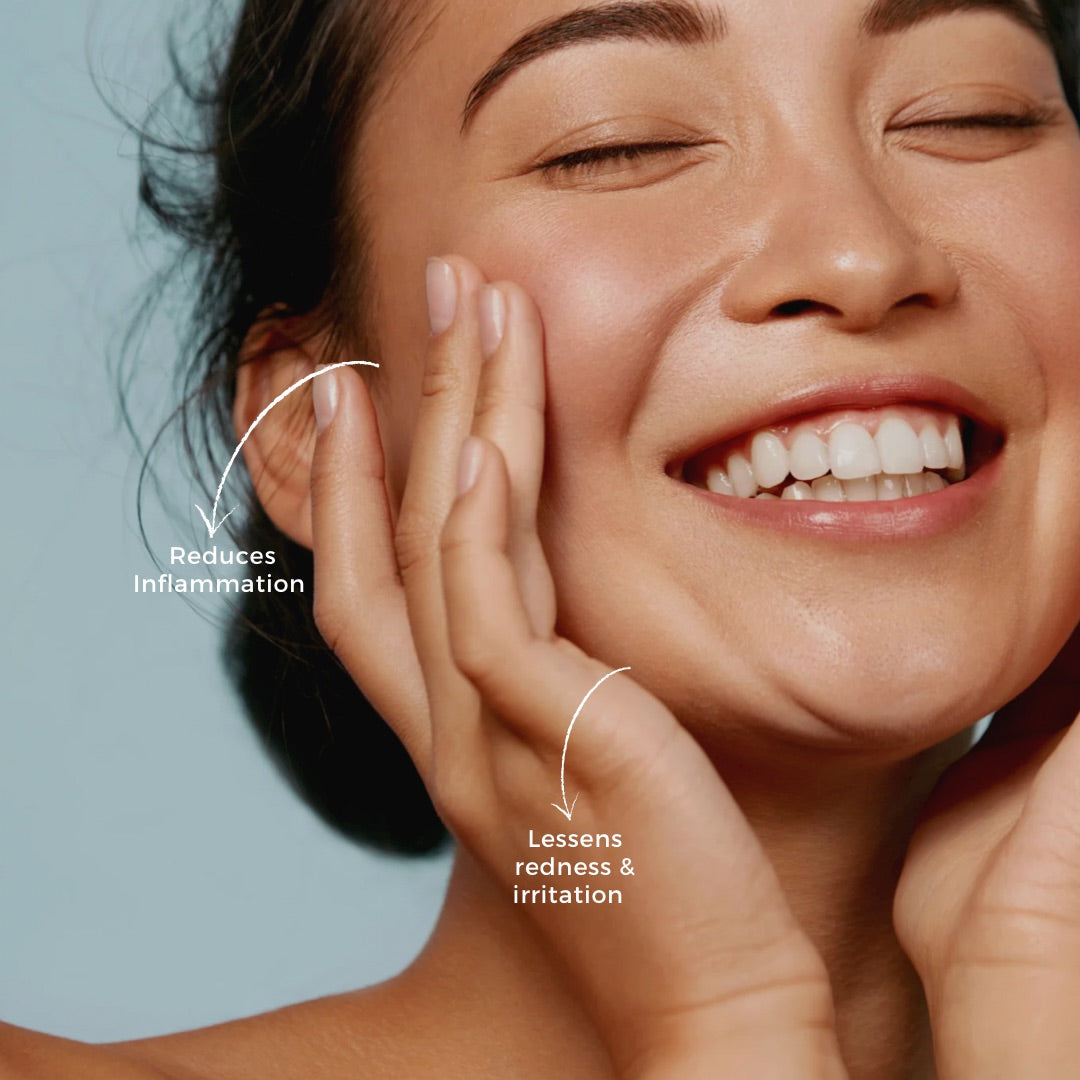 Anti Flare Up Spritz - 55ML | Steroid-Free Made From Plants - As Seen On Vogue
